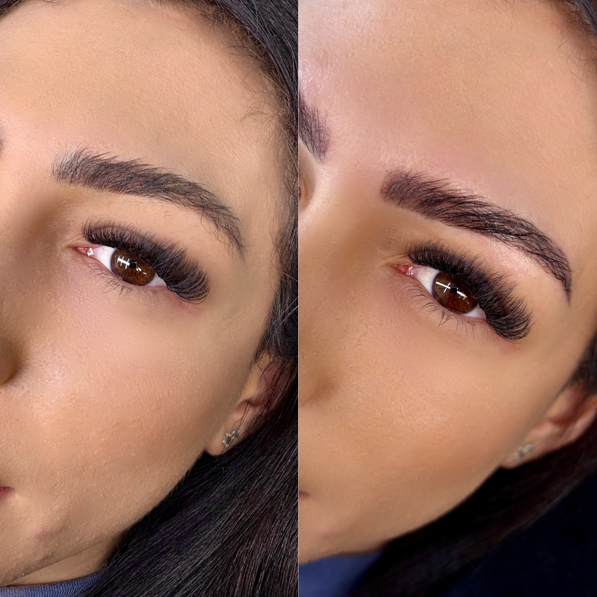 Volume Crystal antes e depois — close olho